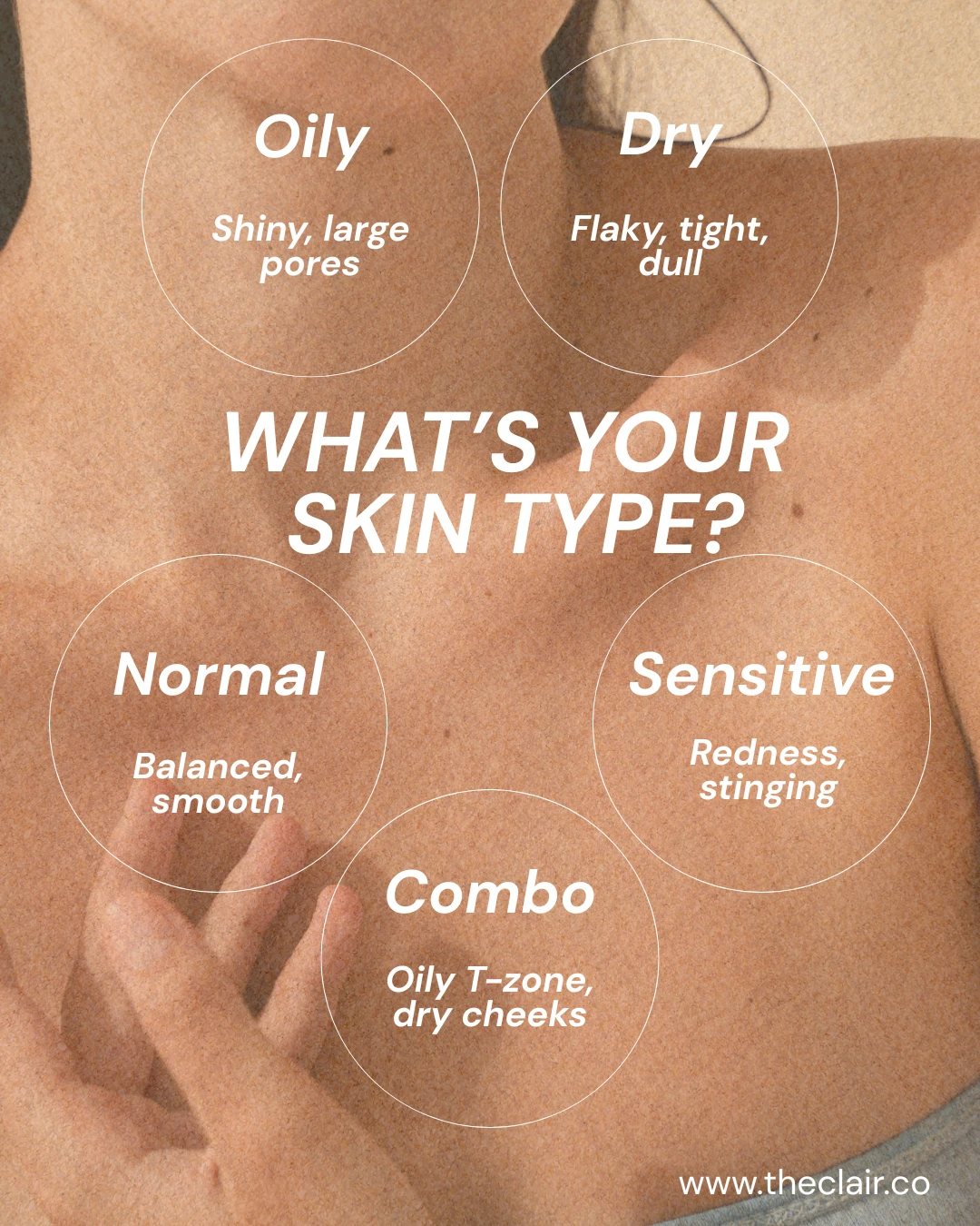 Why Acne Keeps Coming Back: 7 Hidden Causes No One Talks About